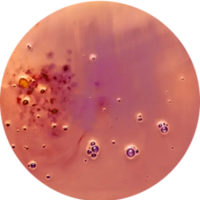 Retinol (Vitamin A)